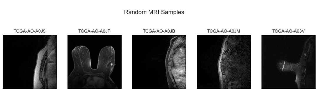 Random Aligned Patient MRI Samples