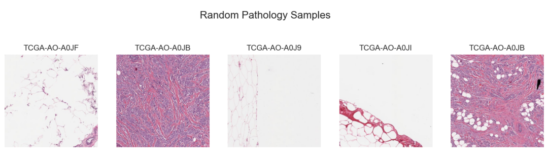 Random Aligned Patient Pathology Patch Samples